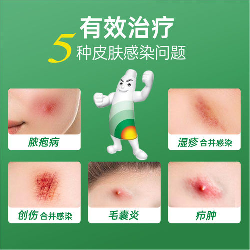 百多邦莫匹罗星软膏官方旗舰店正品5g*/支毛囊炎外用杀菌皮肤感染 - 图1