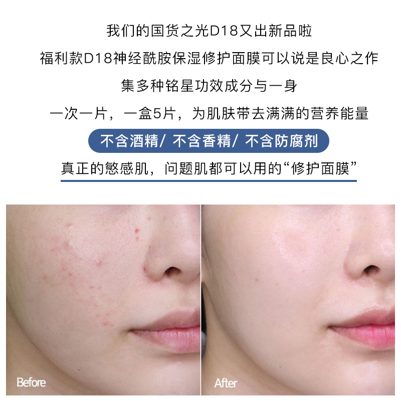 神经酰胺保湿修护面膜女 片装 5 国货之光 D18 提亮嫩肤紧致面部精华 神经酰胺保湿修护面膜女 片装 5 国货之光 D18 提亮嫩肤紧致面部精华