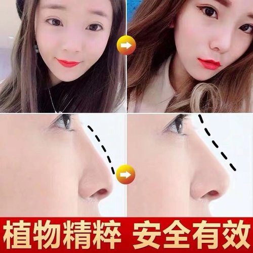 【小红书推荐 美鼻神器】告别丑鼻子精油变高山根鼻梁精华液挺鼻 - 图0