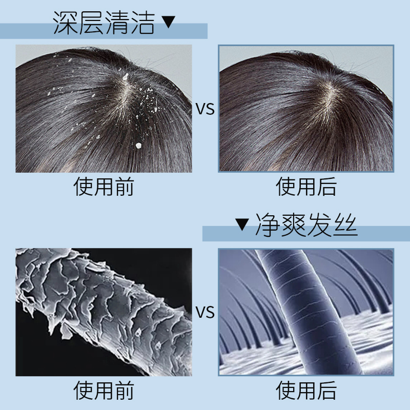 欧莱雅PRO沙龙星河瓶芯基源净澈丰盈蓬松洗发水改善洗发露洗头膏