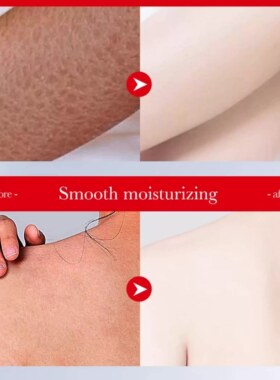 曲酸身体乳 Kojic Acid Tender Whiten Body Lotion Moist Smooth