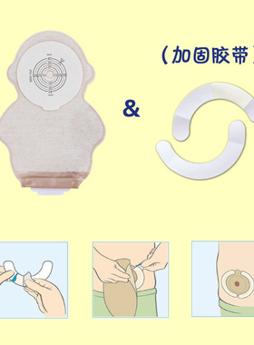 儿童造口袋101040新生婴幼儿一件式造瘘袋一次性大便袋