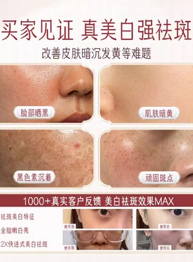 迷奇美白赋颜嫩肤乳霜牡丹系列祛斑祛黄褐斑雀斑淡化色斑水乳面霜