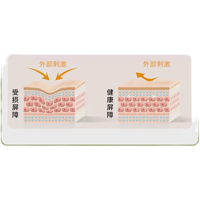 蒙琪敏感肌修护霜淡化红血丝补水舒缓脸部角质层保湿敏感肌套装_蒙琪品牌官方店_美容护肤_美体_精油-第3张图片-提都小院