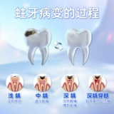 Gaolingjie Комплексная анти -膏 Зубная паста, свежее дыхание, фторид, содержащий фторин, содержащий флагманский магазин Официальный подлинная подлинная такая же модель 130G