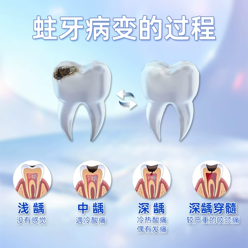 Gaolingjie Комплексная анти -膏 Зубная паста, свежее дыхание, фторид, содержащий фторин, содержащий флагманский магазин Официальный подлинная подлинная такая же модель 130G