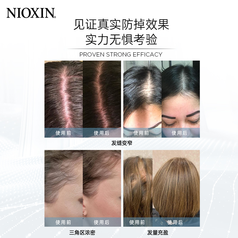 【39.4元购20袋】NIOXIN防掉发洗发水护发素旅行便携试用装10ml-图2