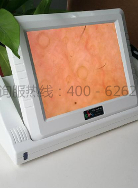 cbs便携式分析仪皮肤镜