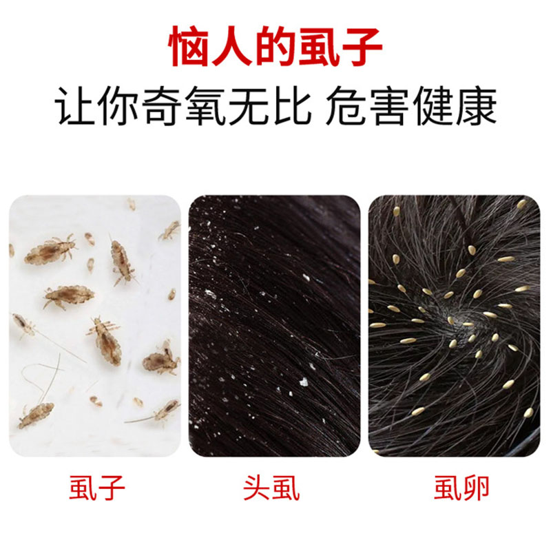 除跳蚤双面梳子头皮屑清理竹节篦子梳儿童宠物超密齿双面虱子梳-图3