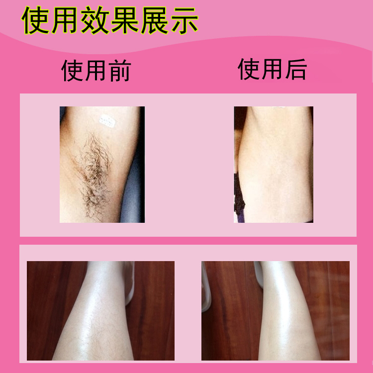 女士专用剃毛刀比基尼刮毛刀除脱毛刀腋毛私处腋下私密女用脱毛器-图1