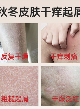 身体乳沐浴油套装身体保湿滋润皮肤干燥起皮沐浴露干痒秋冬季洗浴