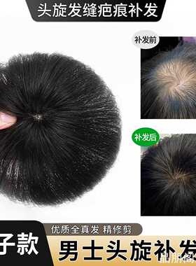 个性遮秃发片斑秃脱发男士假真发片假发片男全真发ins风