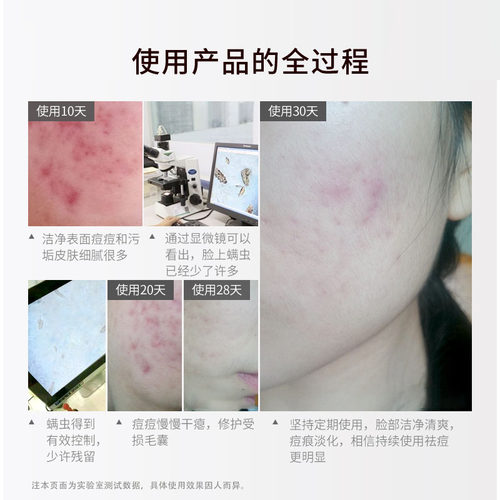 遇见香芬硫磺香皂洗脸皂男女脸背部清洁净肤旗舰店正品官方品牌氛 - 图3