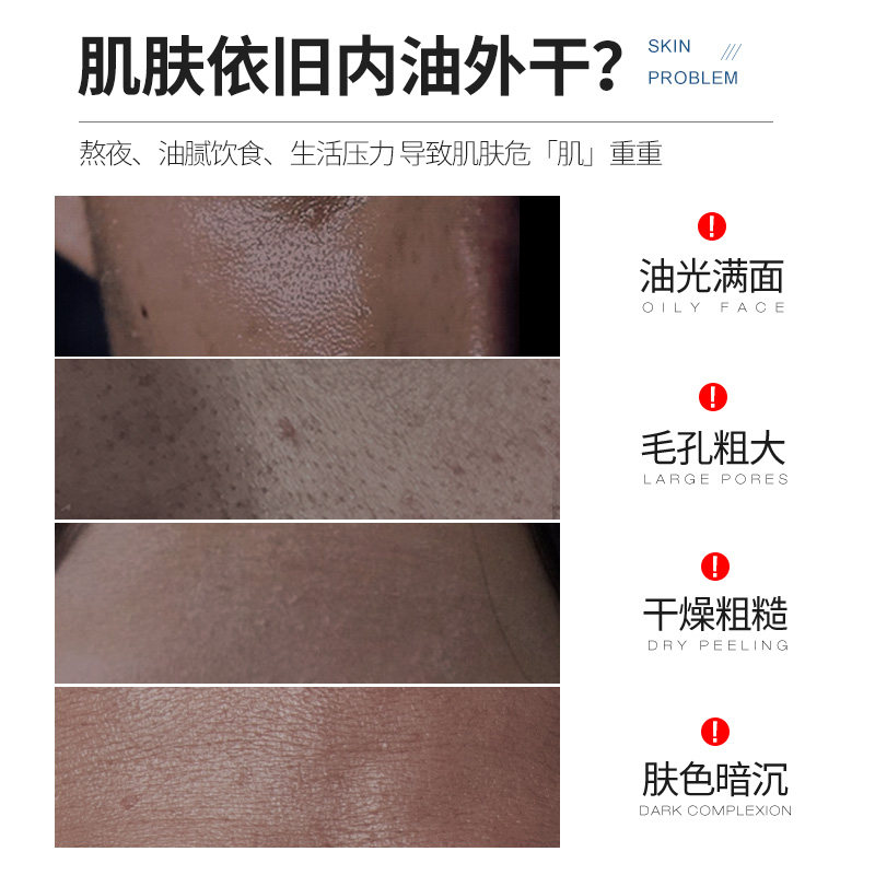 男士秋冬季补水擦脸油男生润肤乳 manfriend男士面部乳霜