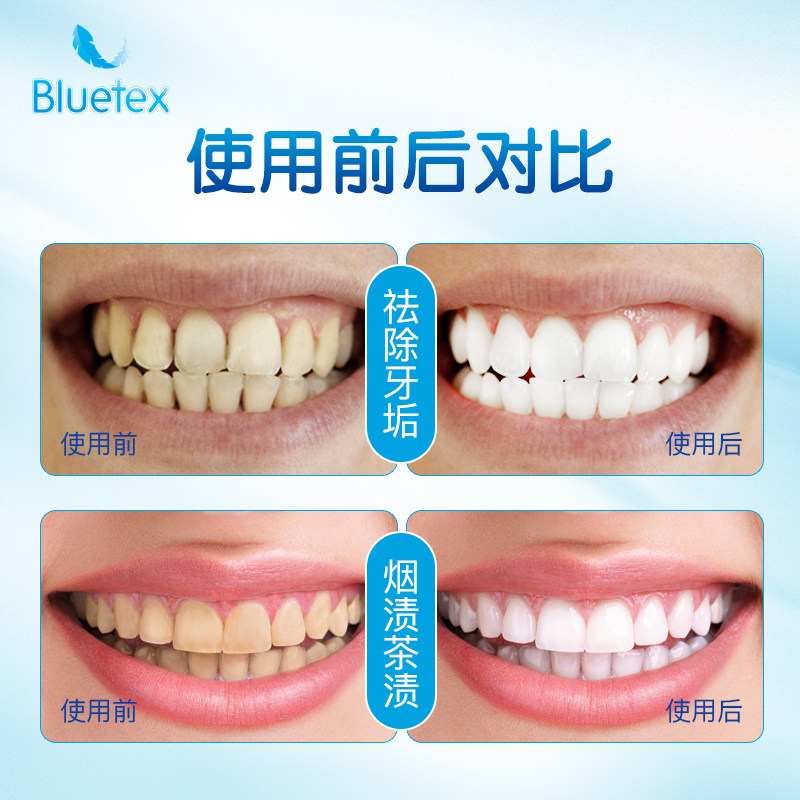 蓝宝丝美白美去黄洁白牙齿快速牙贴 bluetex牙齿美白脱色剂