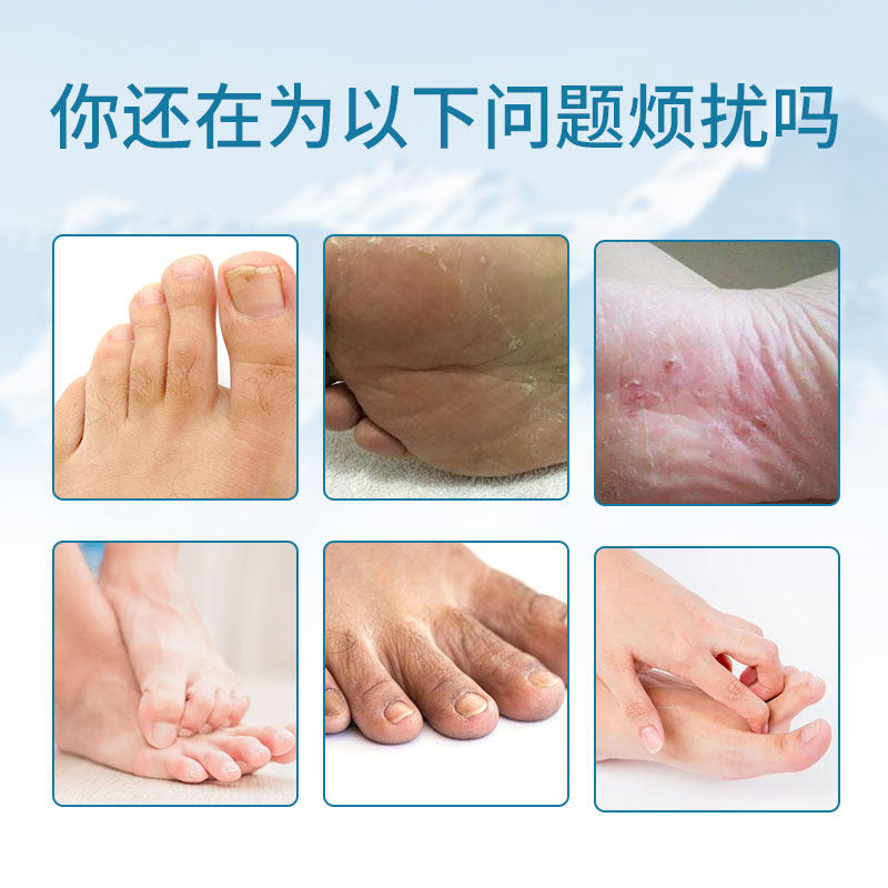 【买3送1买5送2】狼和狼毒足部脚喷剂 狼和皮肤消毒护理（消）