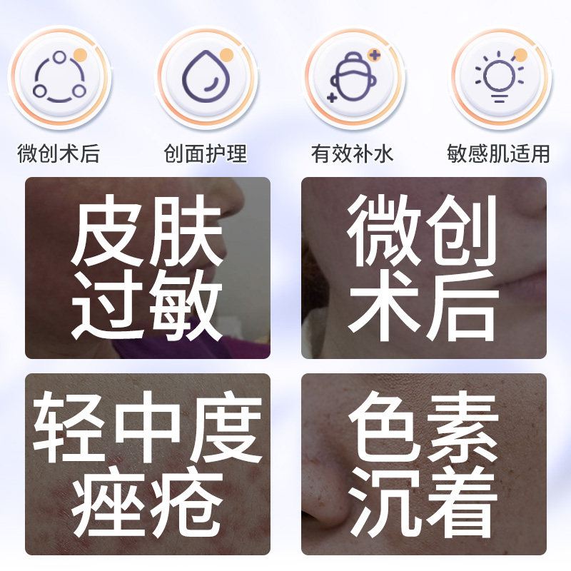 泰恩康医用皮肤修护贴痘痘透明质酸 泰恩康伤口敷料