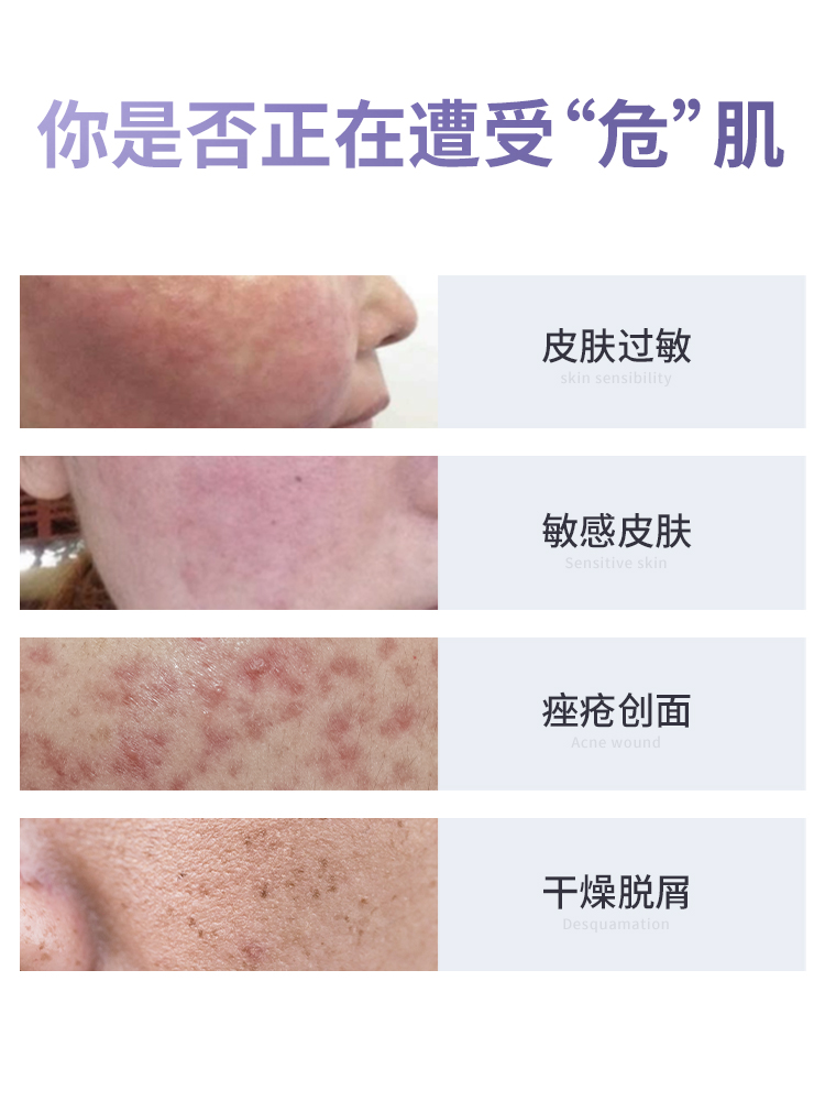 医用透明质酸皮肤修护凝胶皮肤过敏轻中度痤疮创面护理敷料