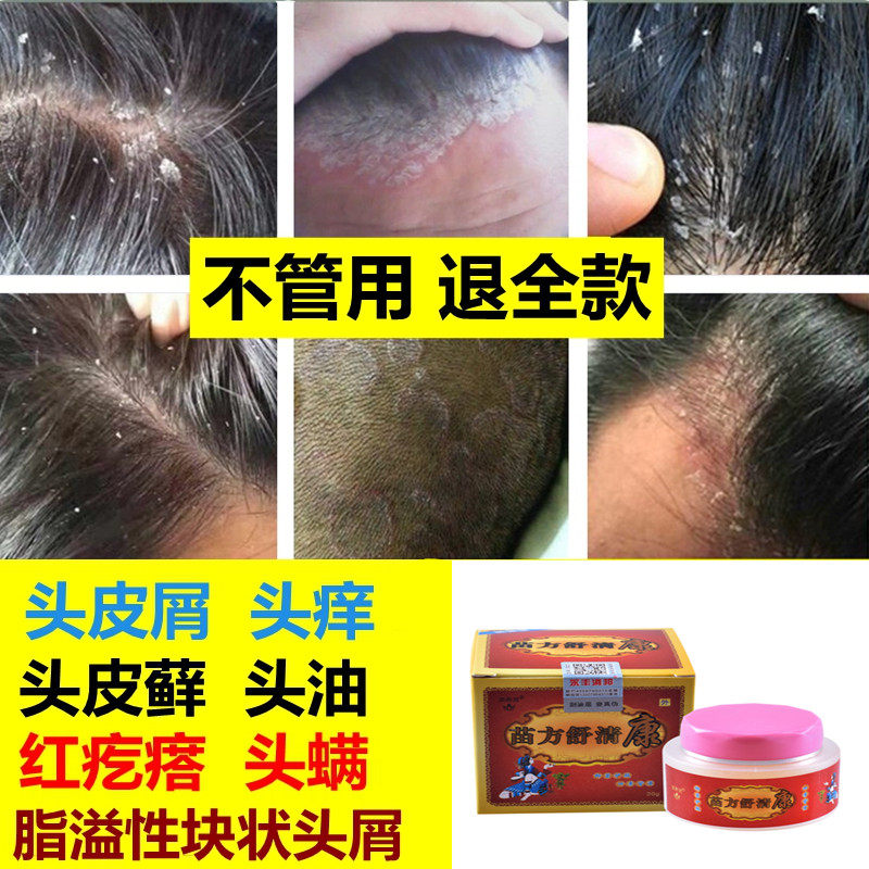 头皮藓洗发水推荐品牌 新人首单立减十元 21年6月 淘宝海外