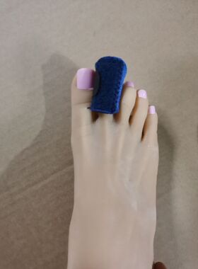 骨折手指脚趾支具矫正器