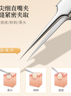 不锈钢黑头夹弯头粉刺清洁工具