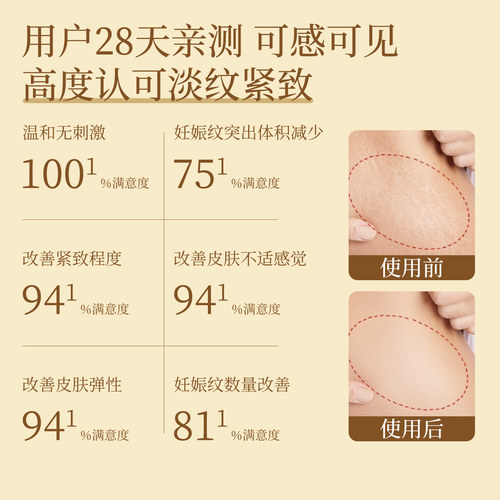 植物主义妊娠油专用预防纹生油橄榄油按摩油护肤品官方旗舰店正品 - 图0
