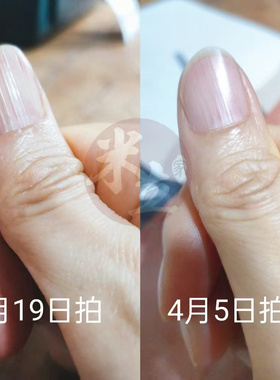 米立植萃护甲精华液|改善倒刺死皮竖纹薄弱|强韧护甲滋养