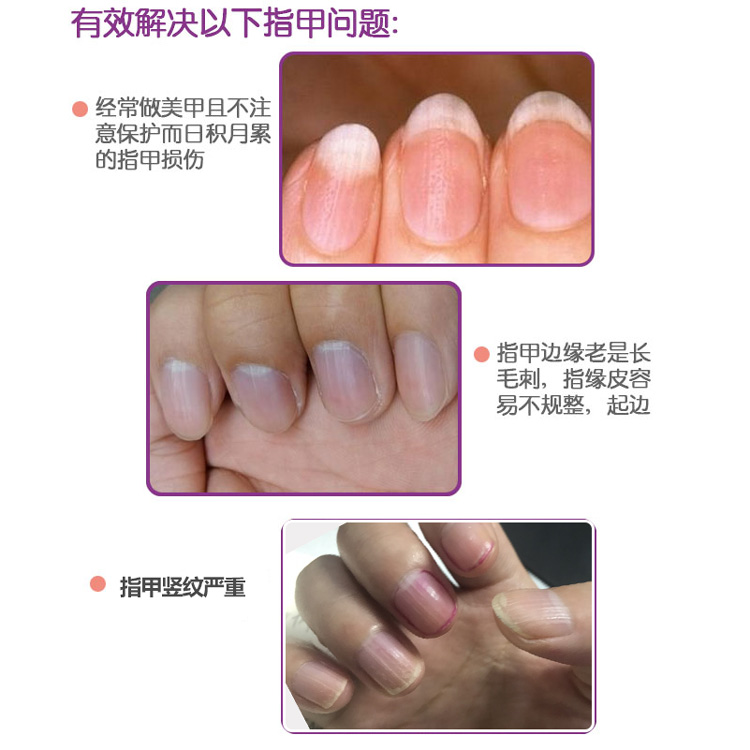 nailtek2号护甲油透明免烤防断裂指甲强化液指甲软薄修复变硬变厚 - 图2