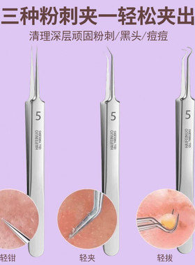 细胞夹尖头针细胞夹去黑头夹子尖头针祛痘神器细胞夹去粉刺套装