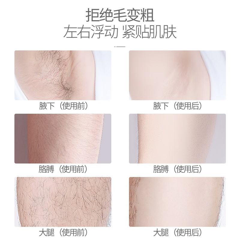 奔腾电动剃毛器女士私密处刮毛刀阴腋毛脱毛神器去腿毛专用送女生-图2