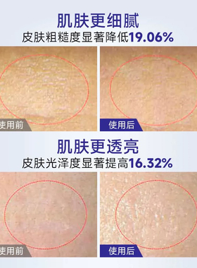 EITIKO5%烟酰胺焕亮保湿精华水补水保湿滋润
