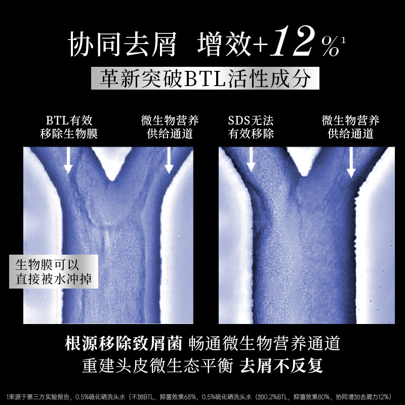 滋源二硫化硒去屑控油洗发水无硅油修护止痒舒缓洗发露旗舰店正品 - 图1