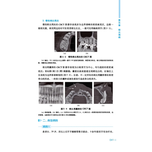 牙体牙髓病cbct影像图谱及典型病例分析 林梓桐 等主编 江苏凤凰科学技术出版社 9787571338428 - 图2
