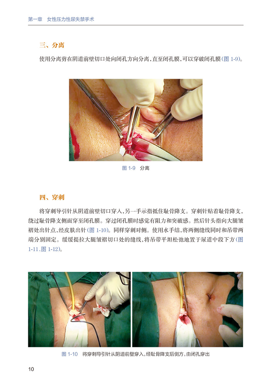 功能泌尿外科手术学许克新主编女性 博蓝图书外科学