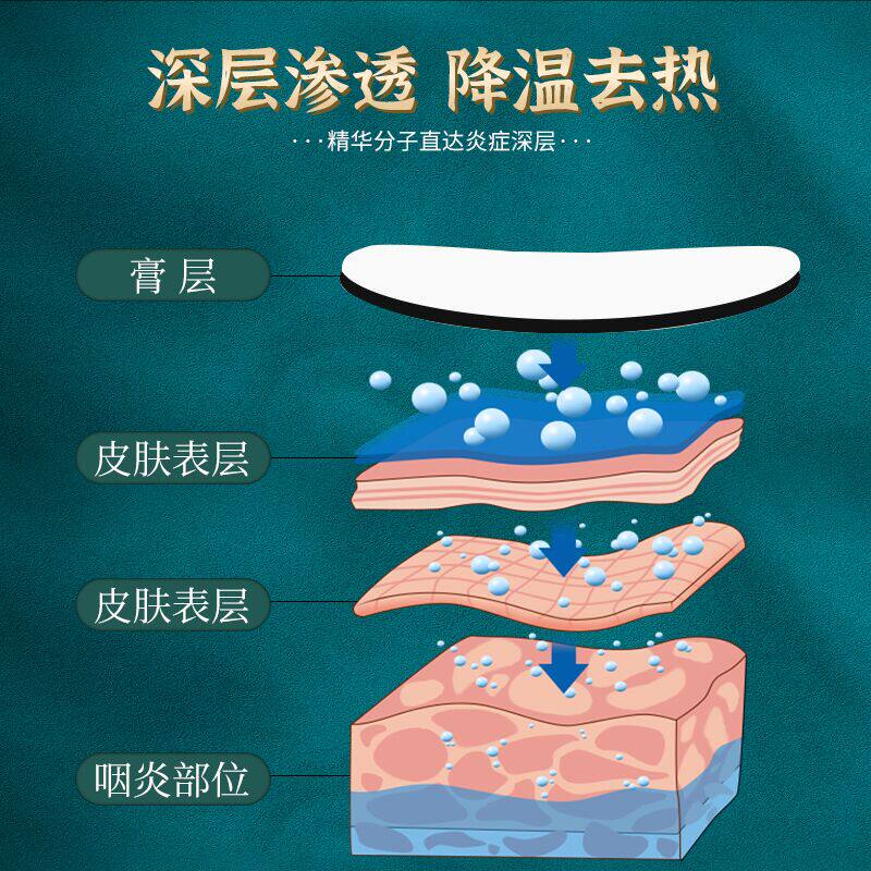 李时珍咽扁康咽炎贴扁桃体发炎yk 幸福村大药房膏药贴（器械）