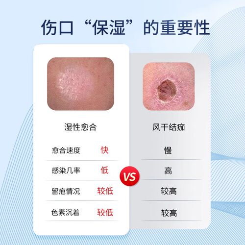 flamigel富林蜜欧洲进口促进多种伤口愈合湿润修复水凝胶敷料QX - 图2