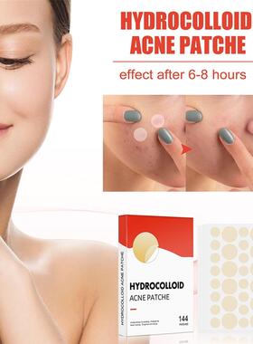 144pcs/set Face Men Women Skin Care Acne Pimple Patch 2