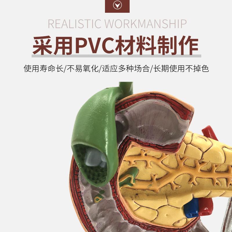 教学仿真a病变胰脾肝胆十二指肠模型病理胰腺标本人体器官解剖医 - 图1