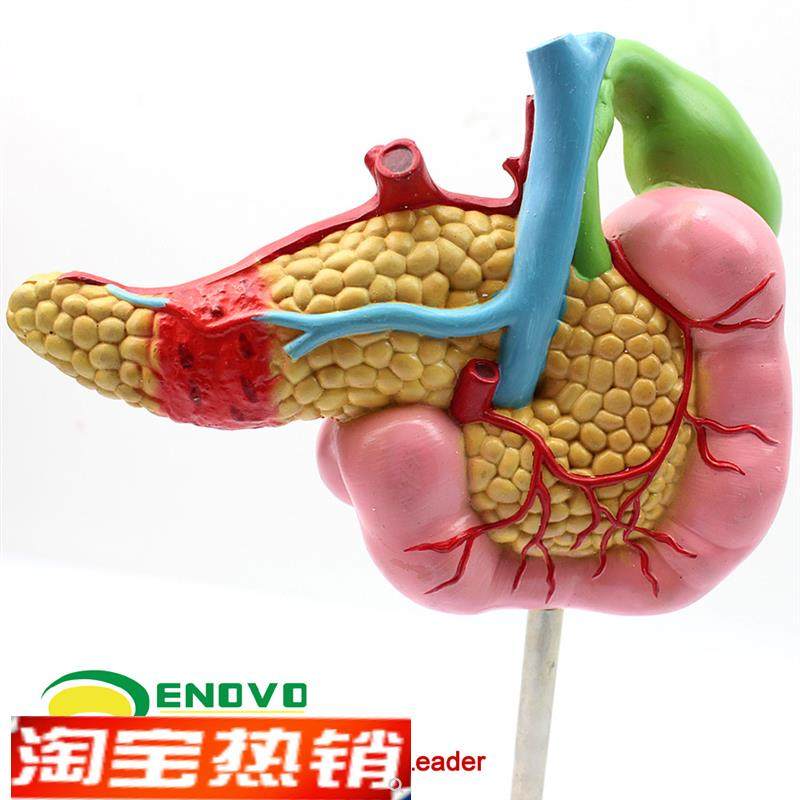 ENOVO颐诺医学胰腺十二指肠胆囊病G理模型外科消化科系统模具肝胆,淘宝优惠券,粉丝福利购,淘宝优惠卷