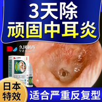 Middle ear inflammation with ear itching bacteriostatic anti-inflammatory person with drop ear liquid fluconazole special can root boric acid ice sheet