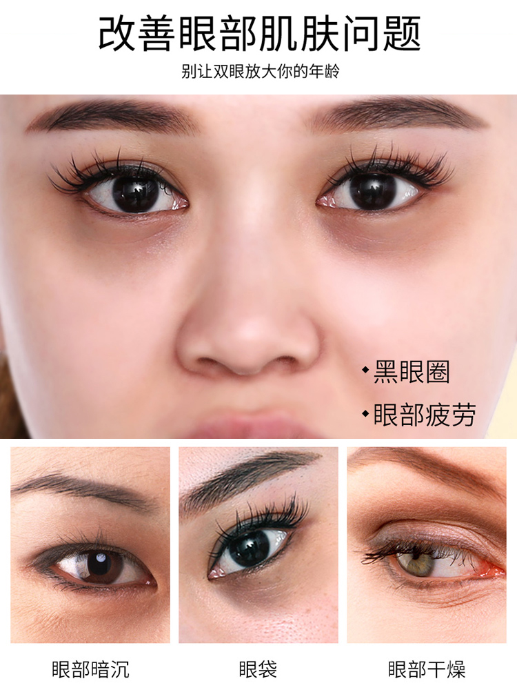 qiskinbo启肤宝旗舰店启肤宝 坚果眼霜淡化黑眼圈眼袋抗皱细纹男女脂肪粒紧致补水保湿2