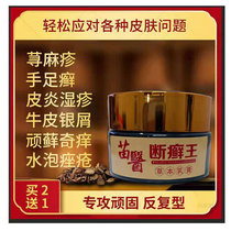 Dermatosis Special treatment Hand tinea fungi Infection with blisters eczema Eczema Antipruritic Psoriasis Hand-foot-footed Cream