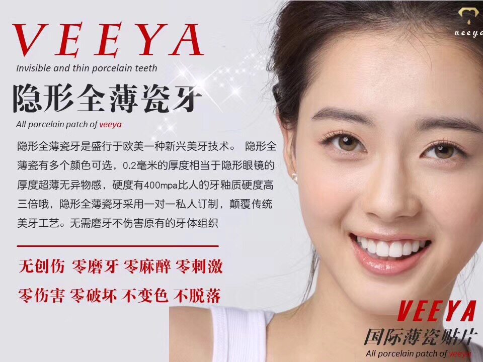全瓷牙贴面冰瓷牙 逸之兴医疗器械6863口腔科材料