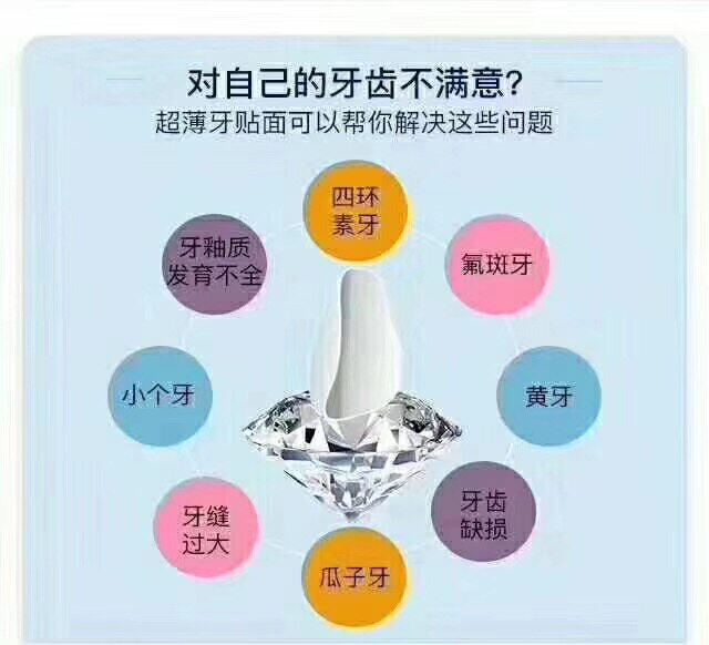 全瓷牙贴面冰瓷牙 逸之兴医疗器械6863口腔科材料