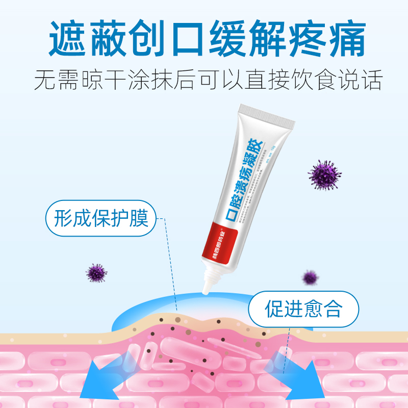 杨四郎口腔溃疡凝胶舌头嘴巴起泡上火口腔溃疡膏创面儿童妇女正品