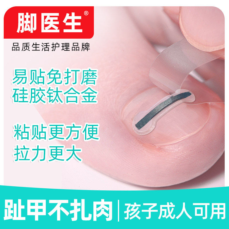 脚医生甲沟嵌甲矫正器炎正甲贴拉拉脚沟卷甲脚趾甲贴指甲长肉里