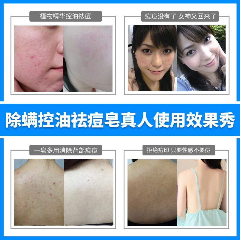 满婷除螨控油 一行家居香皂