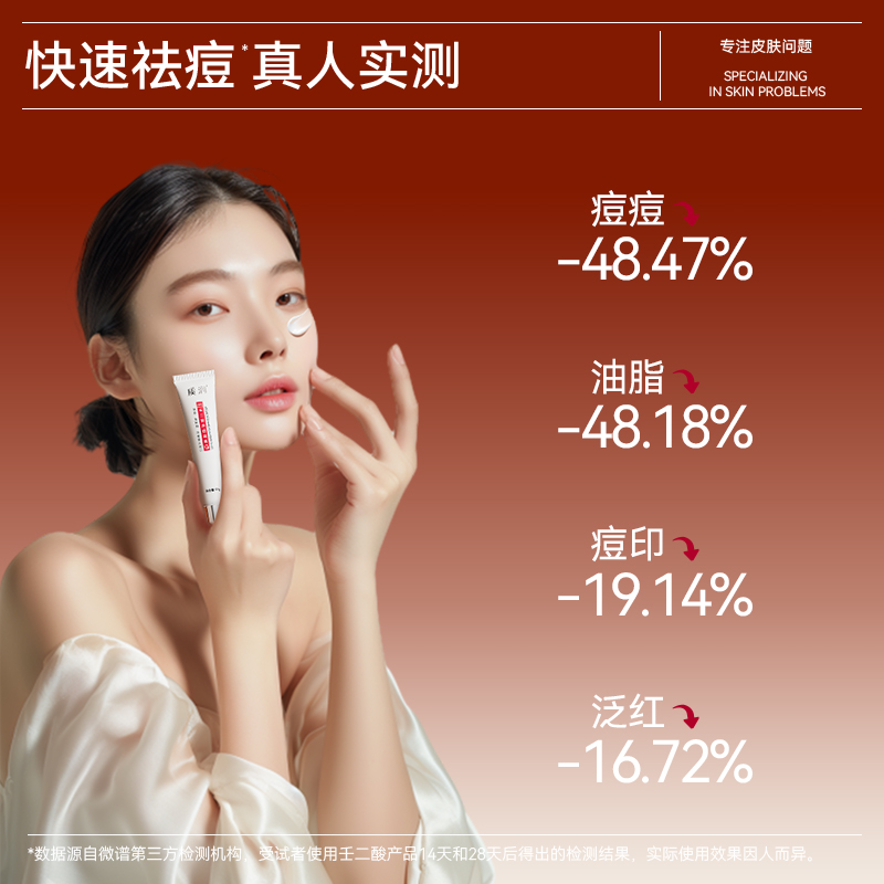 壬二酸祛痘凝胶医用甲硝唑凝胶祛痘印修复淡化壬二酸凝胶官方旗舰