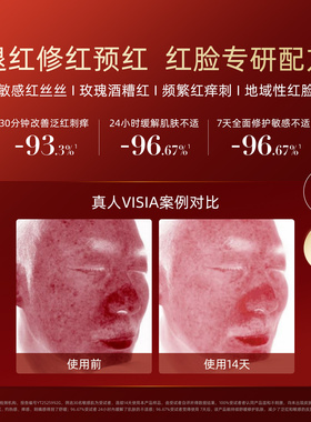 肌本演绎舒缓泛红次抛精华