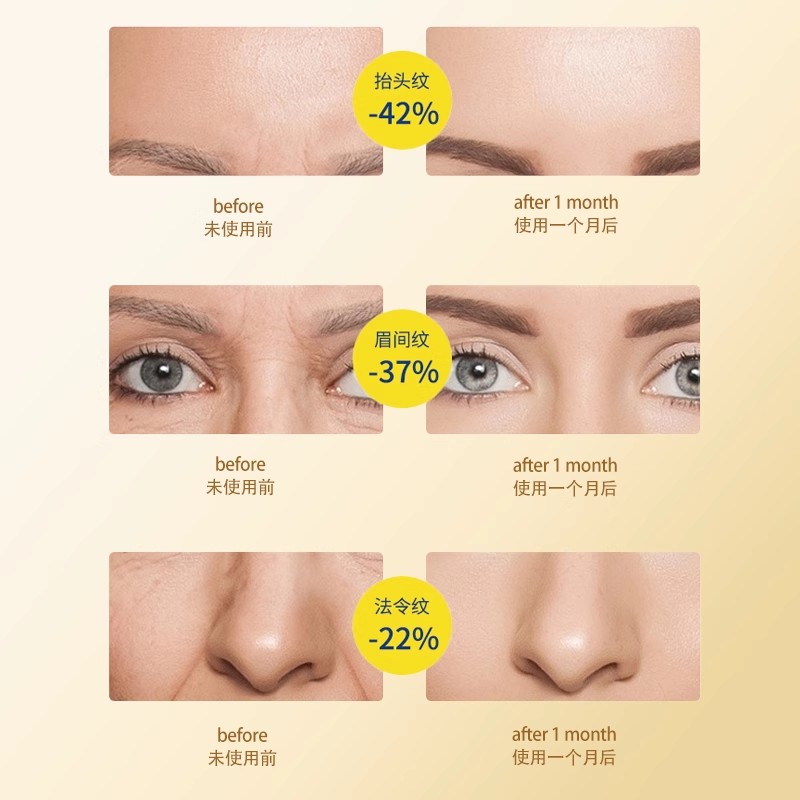 【胖胖优选】密罗木精油面部抗皱紧致淡纹舒缓修护保湿以油养肤 - 图1